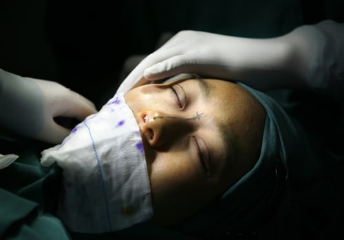 What percentage of people regret their plastic surgery?