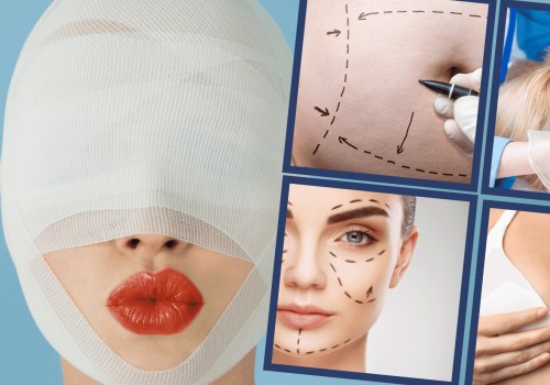 Exploring the Risks of Plastic Surgery