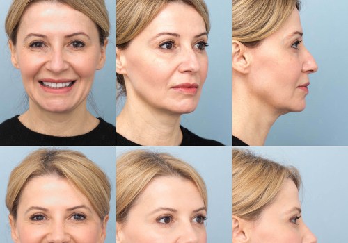 Understanding Desired Aesthetic Outcomes in Plastic Surgery