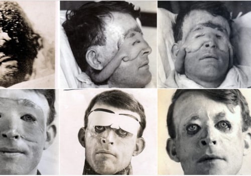 Why is it called plastic surgery?